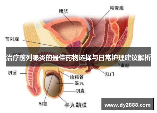 治疗前列腺炎的最佳药物选择与日常护理建议解析