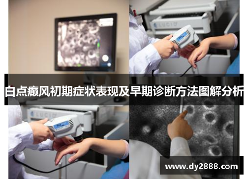 白点癫风初期症状表现及早期诊断方法图解分析